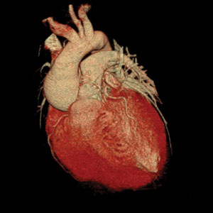 3D CT scan of heart - Houston area radiology at Synergy